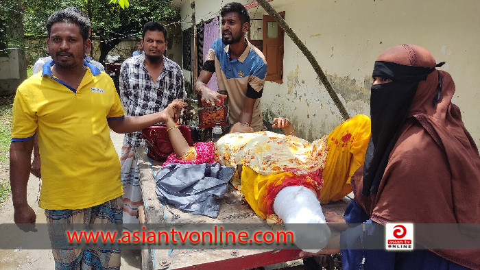 শিবচ‌রে ২ ভ‌্যা‌নের সংর্ঘষে বৃদ্ধার পা বিচ্ছিন্ন