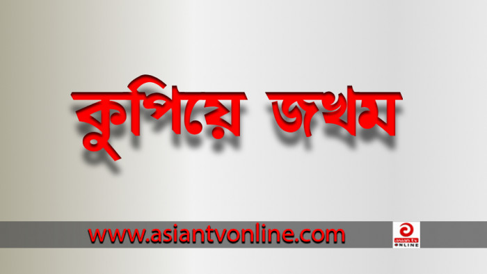 নওগাঁর পারইলে ইউপি চেয়ারম্যানকে কুপিয়ে জখম