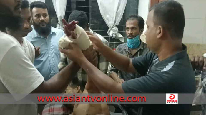 নওগাঁয় সন্ত্রাসী হামলায় যুবদলের এক নেতা গুলিবিদ্ধ, জখম আরও তিন