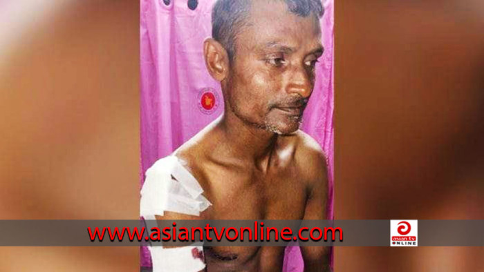 মিয়ানমারের নৌবাহিনীর গুলিতে জেলে আহত
