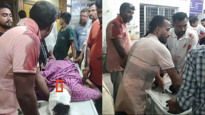কবিরহাটে বৃদ্ধাকে কুপিয়ে স্বর্ণালংকার ও টাকা লুট
