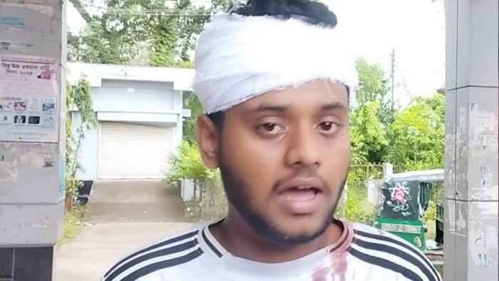 নোয়াখালীতে ডাব চুরিকে কেন্দ্র করে দুই পক্ষের ৫ জন আহত